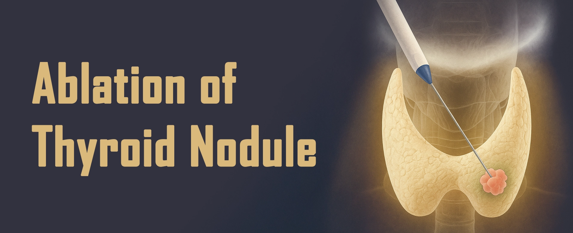 ablation-of-thyroid-nodule