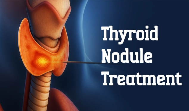 thyroid nodule treatment